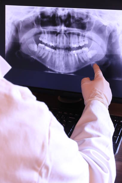 Best Emergency Dentist for Knocked-Out Tooth in Stottville, NY